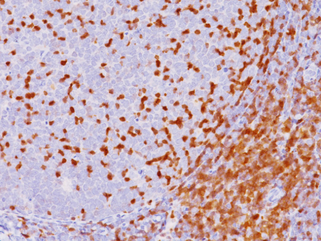 ANTICUERPO MONOCLONAL ZAP-70 (LR), CLONA BC.2F3.2, ISOTIPO IgG2a, CONCENTRADO X 0.1 ML